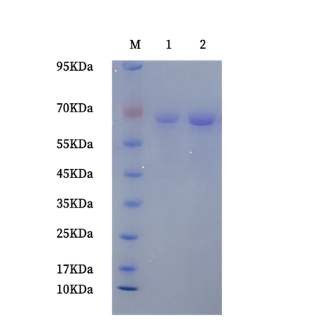 M: Marker
Lane 1-2: Recombinant Human Tau-441 Protein